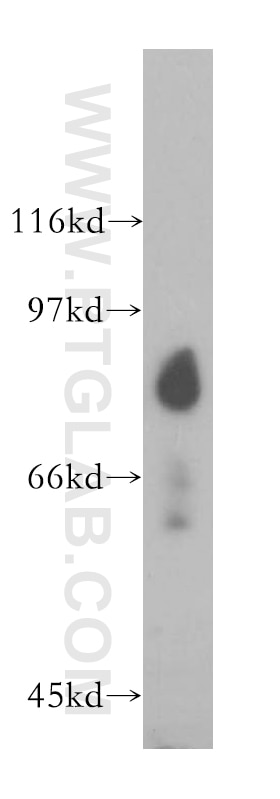Western Blot (WB) analysis of human brain tissue using SH2D3C Polyclonal antibody (12882-1-AP)