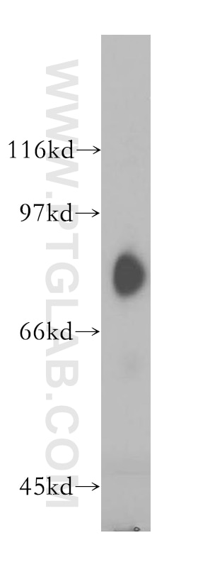 Western Blot (WB) analysis of human placenta tissue using SH2D3C Polyclonal antibody (12882-1-AP)