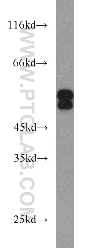 Western Blot (WB) analysis of HeLa cells using SH2D4A Polyclonal antibody (15957-1-AP)