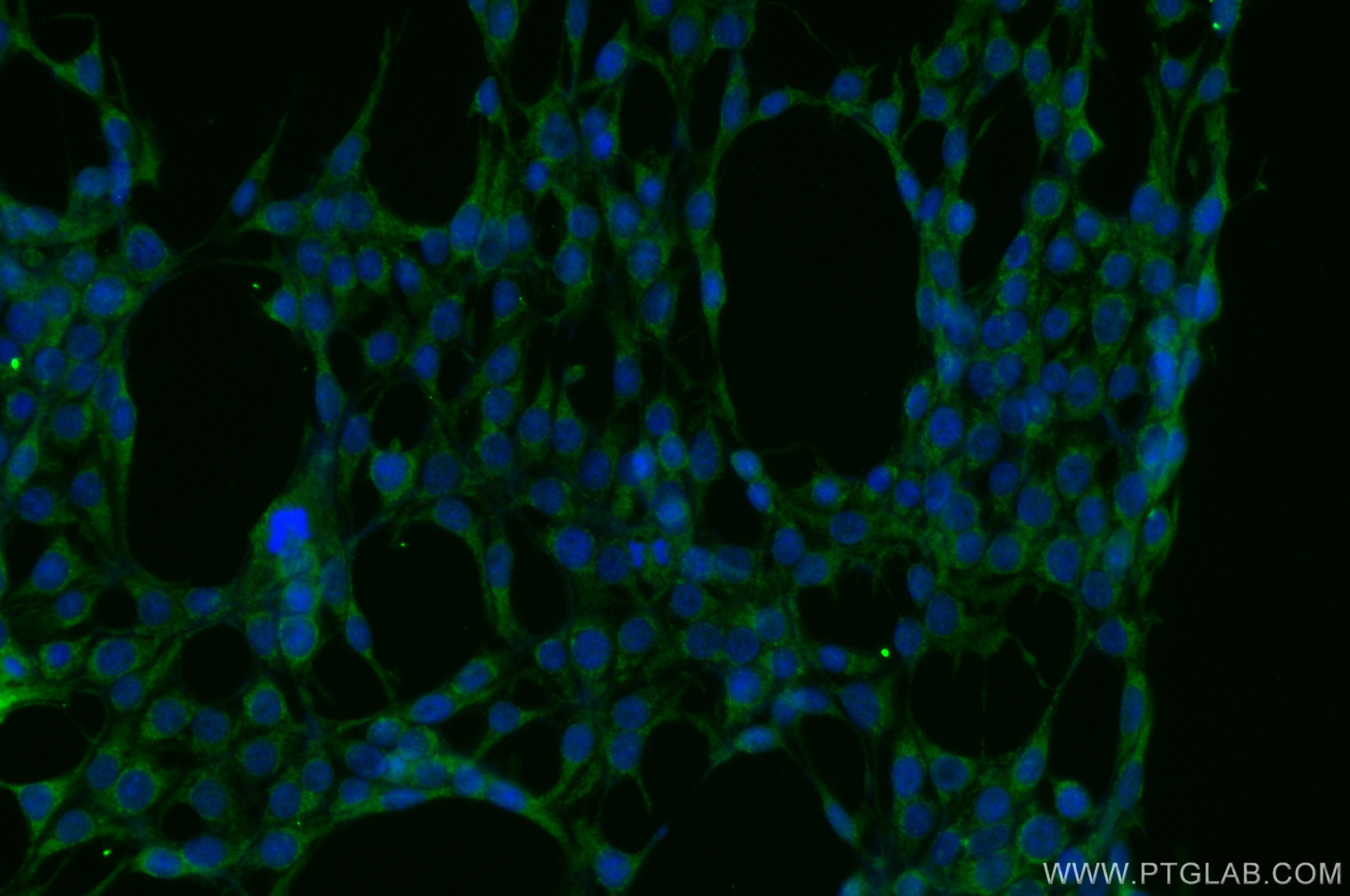 Immunofluorescence (IF) / fluorescent staining of HEK-293 cells using SH2D5 Polyclonal antibody (55320-1-AP)