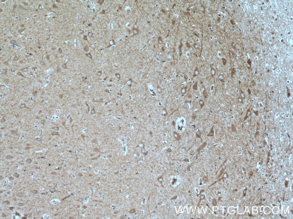 Immunohistochemistry (IHC) staining of human brain tissue using SH2D5 Polyclonal antibody (55320-1-AP)