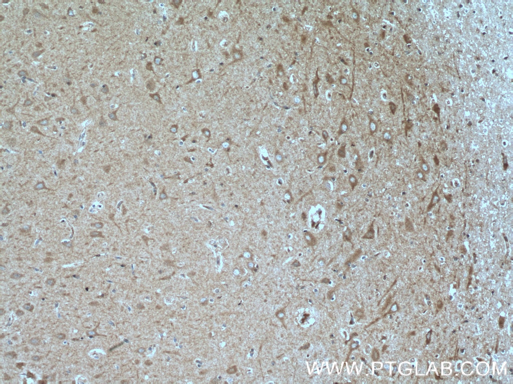 IHC staining of human brain using 55320-1-AP