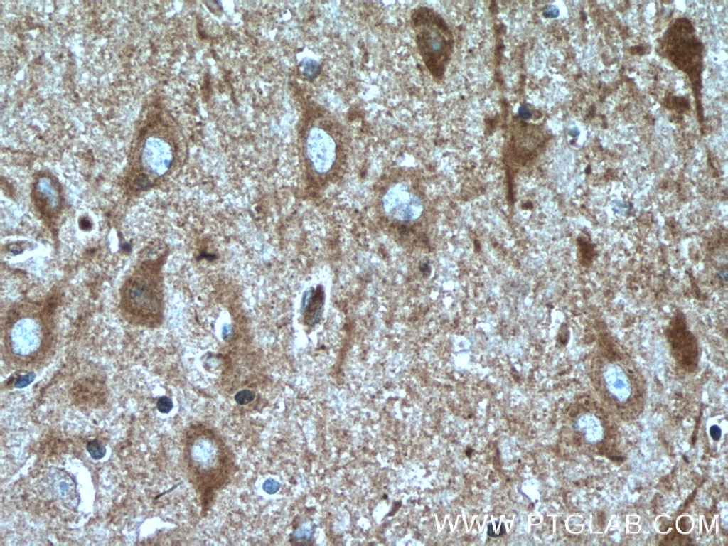 IHC staining of human brain using 55320-1-AP