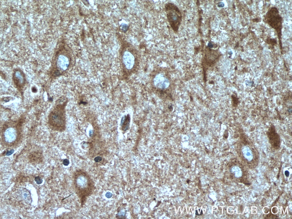 Immunohistochemistry (IHC) staining of human brain tissue using SH2D5 Polyclonal antibody (55320-1-AP)