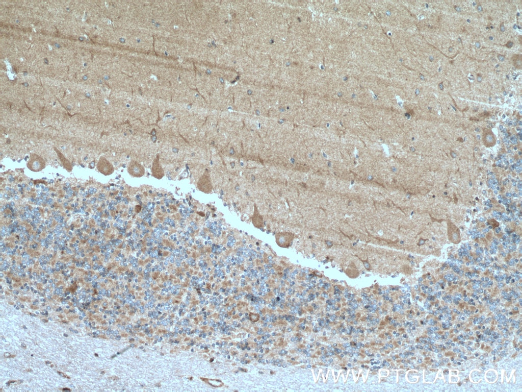 Immunohistochemistry (IHC) staining of human cerebellum tissue using SH2D5 Polyclonal antibody (55320-1-AP)