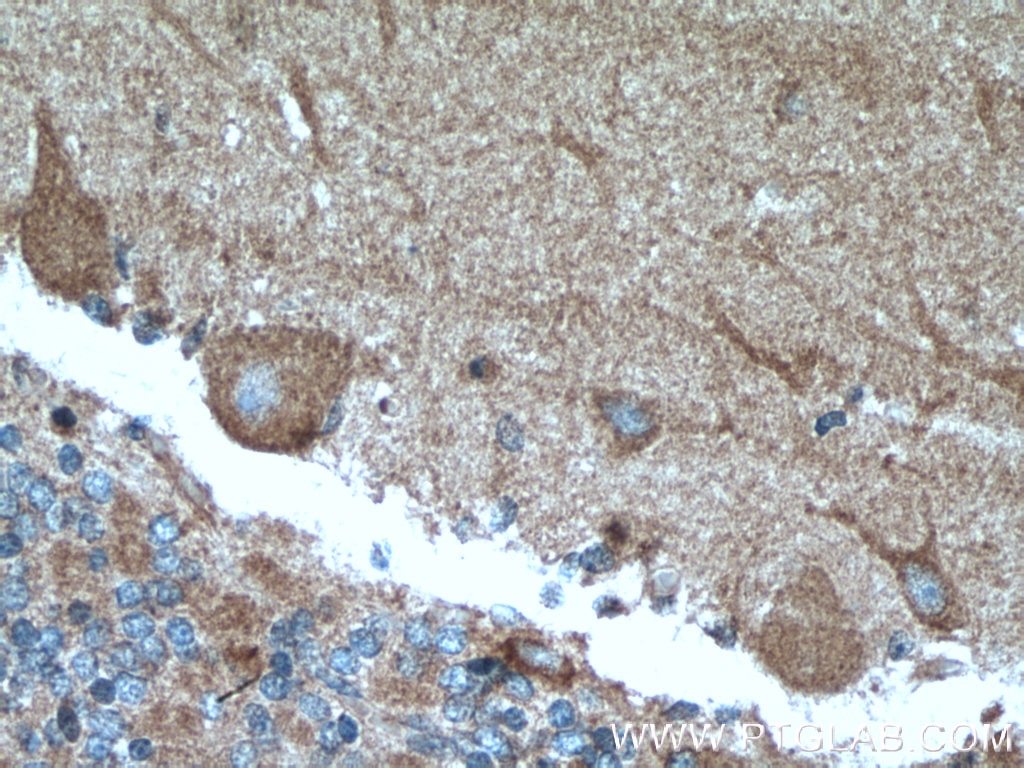 Immunohistochemistry (IHC) staining of human cerebellum tissue using SH2D5 Polyclonal antibody (55320-1-AP)