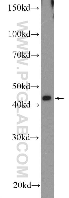 Western Blot (WB) analysis of HEK-293 cells using SH2D5 Polyclonal antibody (55320-1-AP)