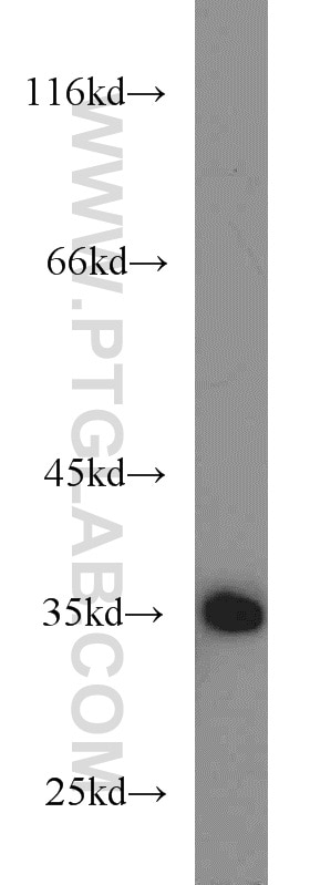 Western Blot (WB) analysis of mouse kidney tissue using SH2D5 Polyclonal antibody (55320-1-AP)