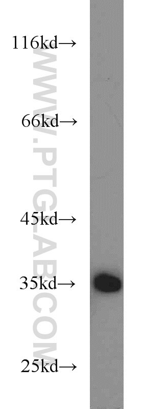 Western Blot (WB) analysis of mouse kidney tissue using SH2D5 Polyclonal antibody (55320-1-AP)