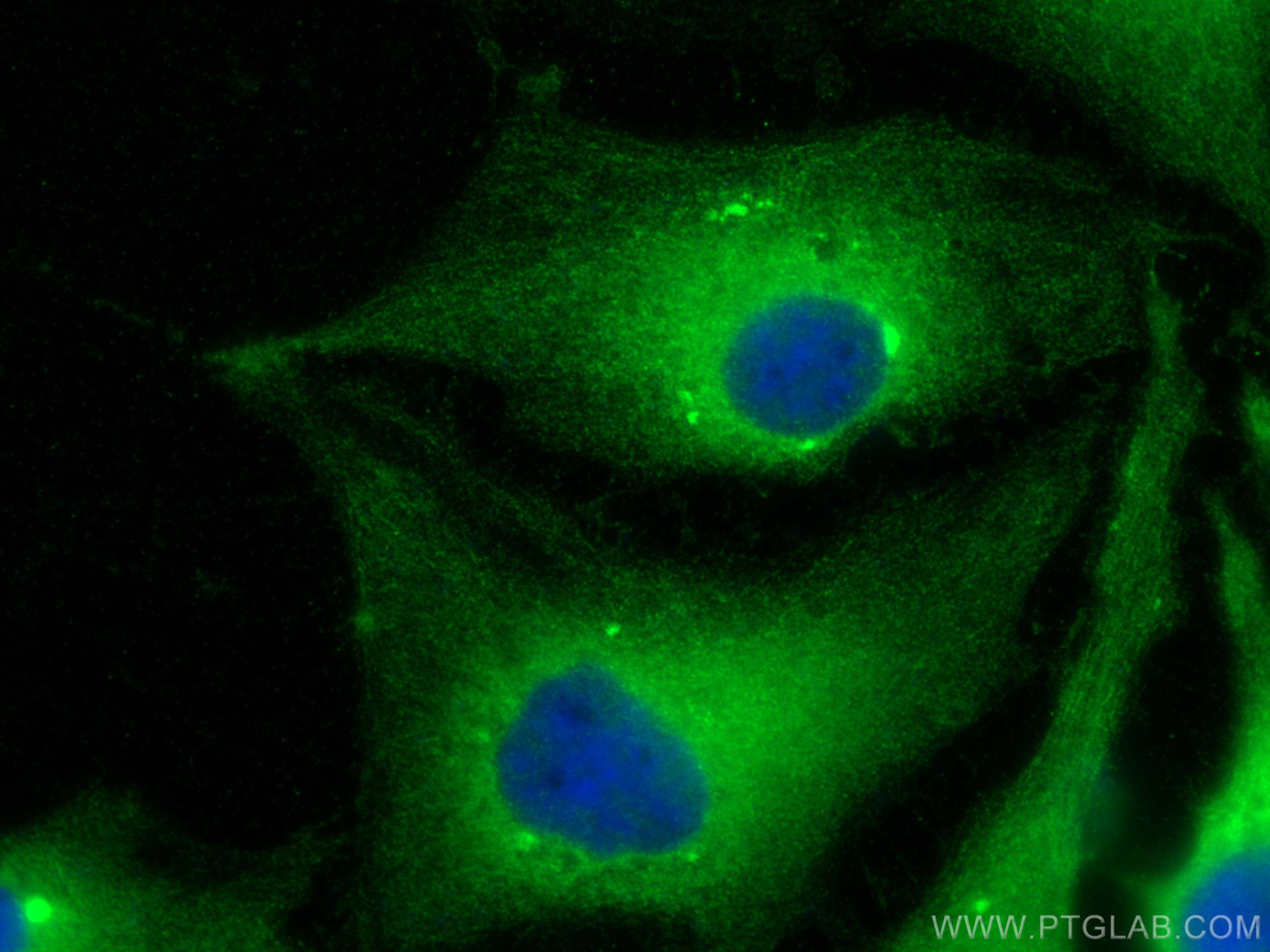 Immunofluorescence (IF) / fluorescent staining of HeLa cells using SH3BGR Polyclonal antibody (21161-1-AP)
