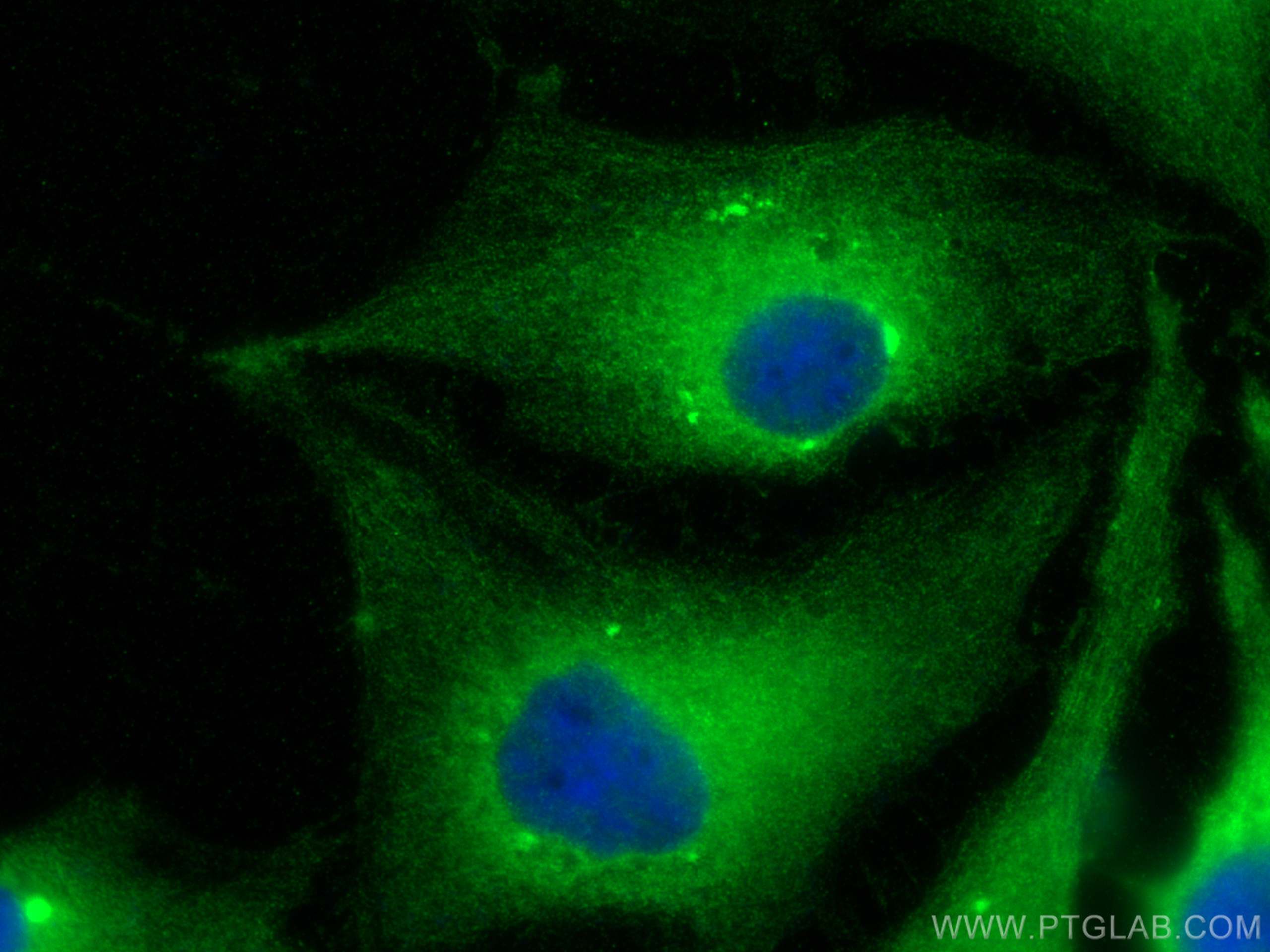 IF Staining of HeLa using 21161-1-AP