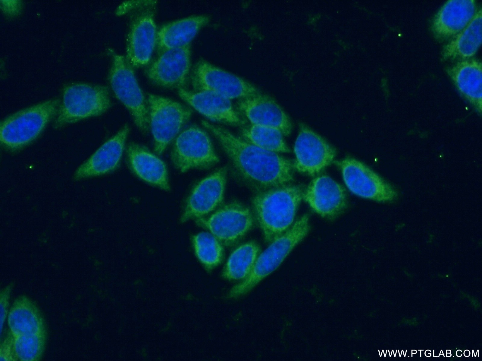 Immunofluorescence (IF) / fluorescent staining of HeLa cells using SH3BGR Polyclonal antibody (21161-1-AP)
