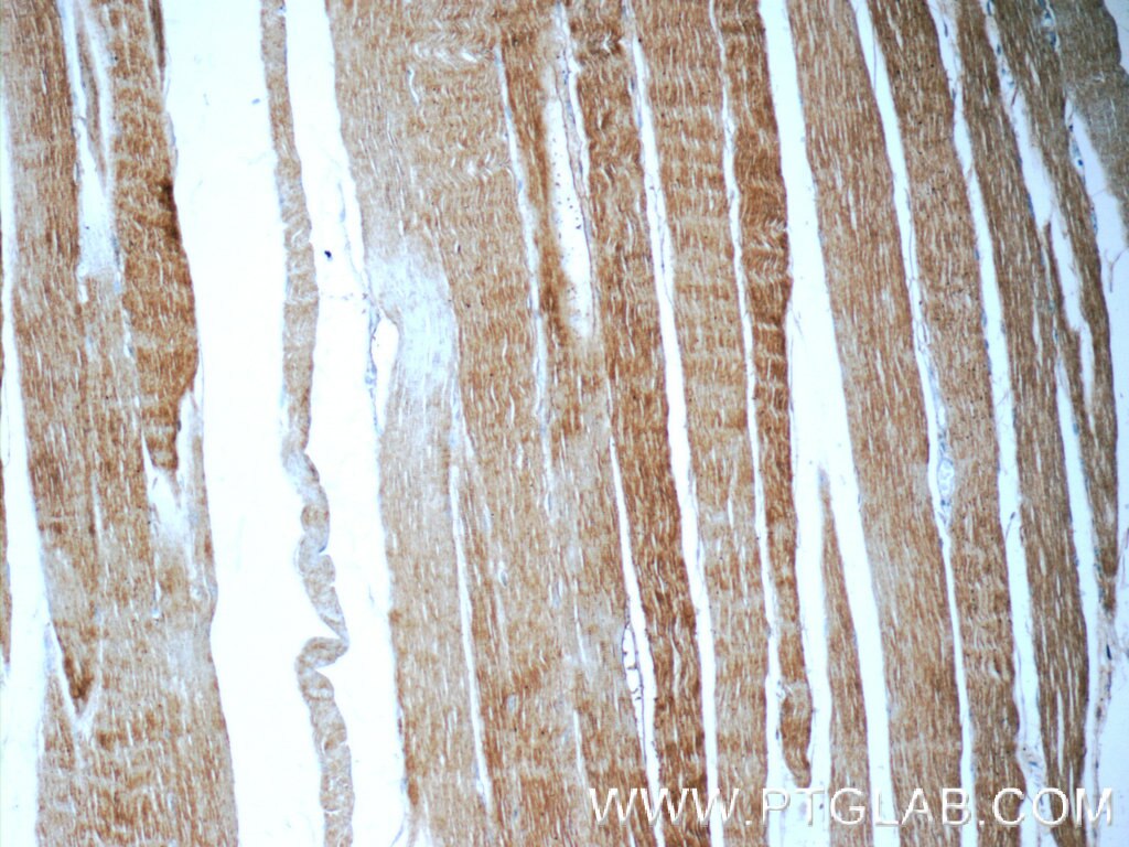 Immunohistochemistry (IHC) staining of human skeletal muscle tissue using SH3BGR Polyclonal antibody (21161-1-AP)