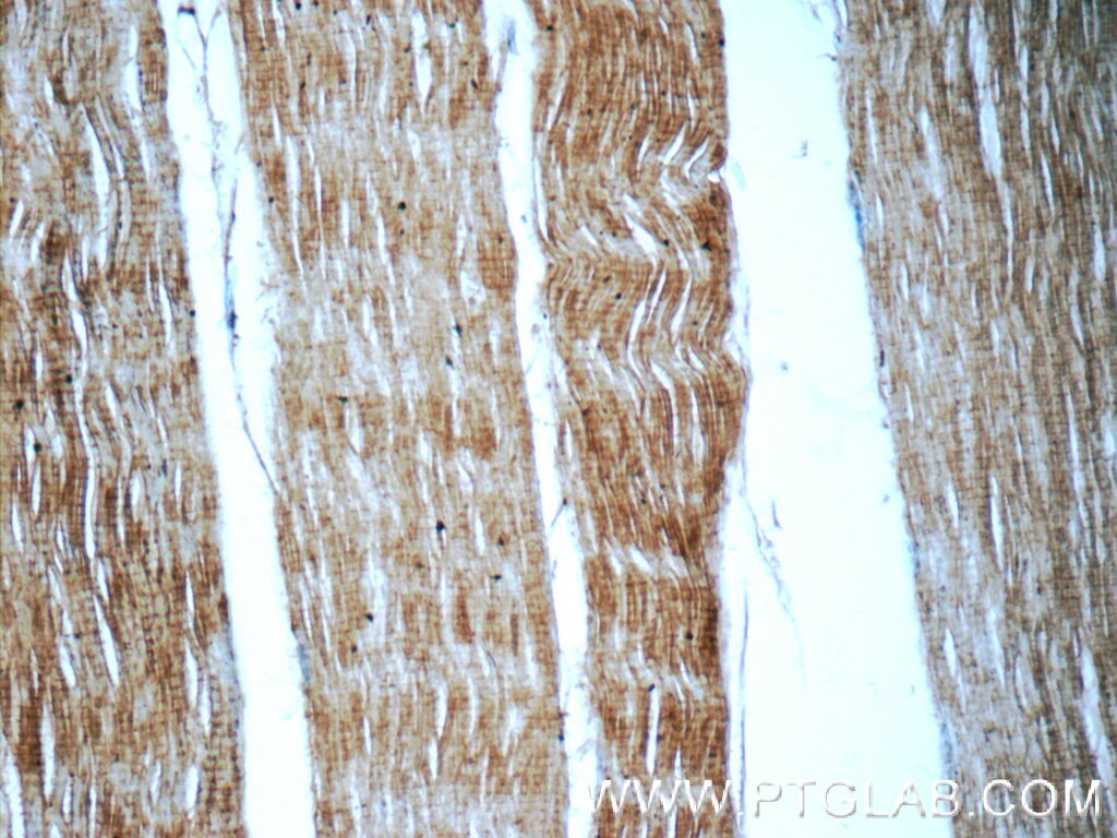 Immunohistochemistry (IHC) staining of human skeletal muscle tissue using SH3BGR Polyclonal antibody (21161-1-AP)