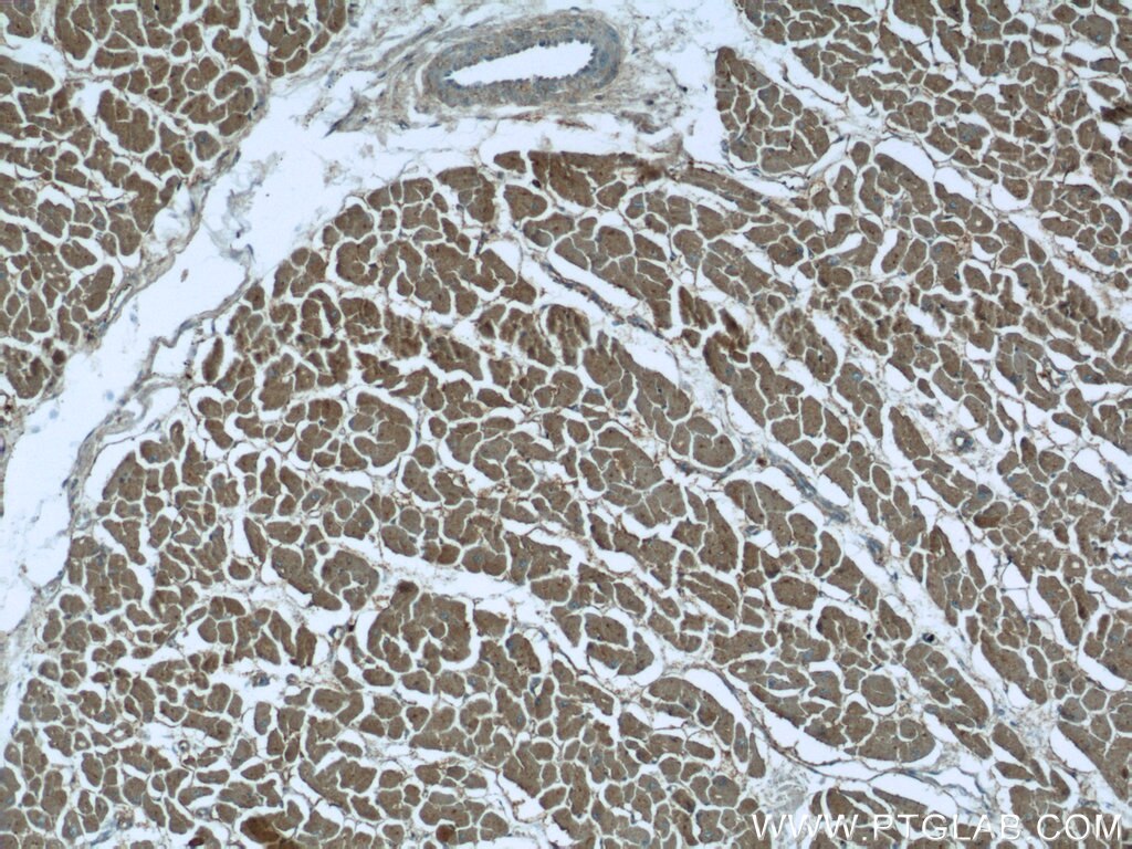 Immunohistochemistry (IHC) staining of human heart tissue using SH3BGR Polyclonal antibody (21161-1-AP)