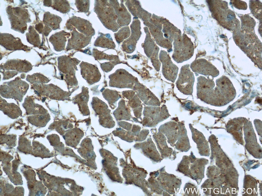 Immunohistochemistry (IHC) staining of human heart tissue using SH3BGR Polyclonal antibody (21161-1-AP)