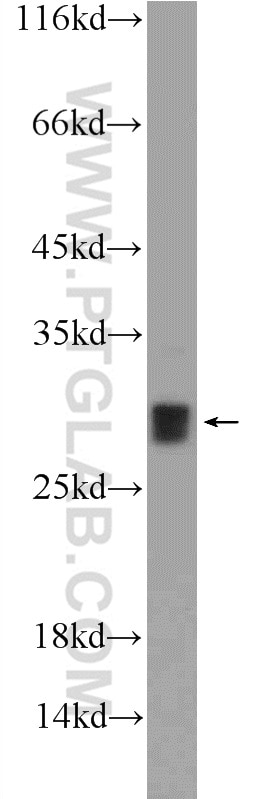 Western Blot (WB) analysis of mouse heart tissue using SH3BGR Polyclonal antibody (21161-1-AP)