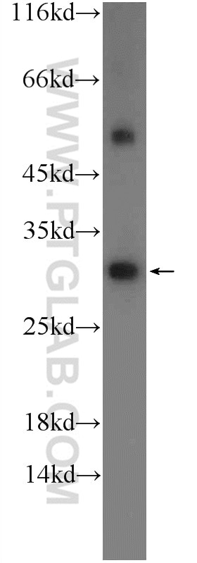 Western Blot (WB) analysis of mouse skeletal muscle tissue using SH3BGR Polyclonal antibody (21161-1-AP)