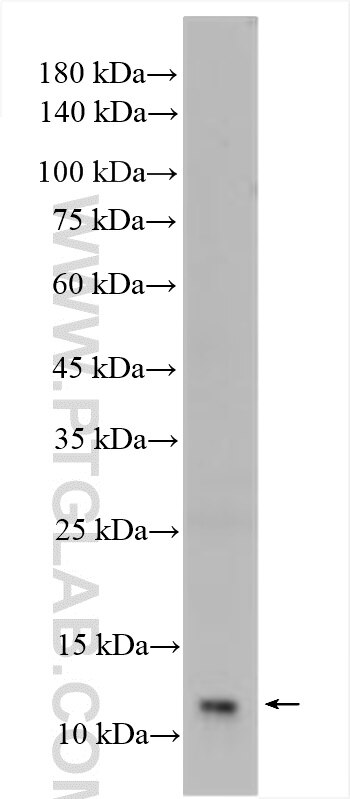 Western Blot (WB) analysis of mouse colon tissue using SH3BGRL Polyclonal antibody (11253-1-AP)