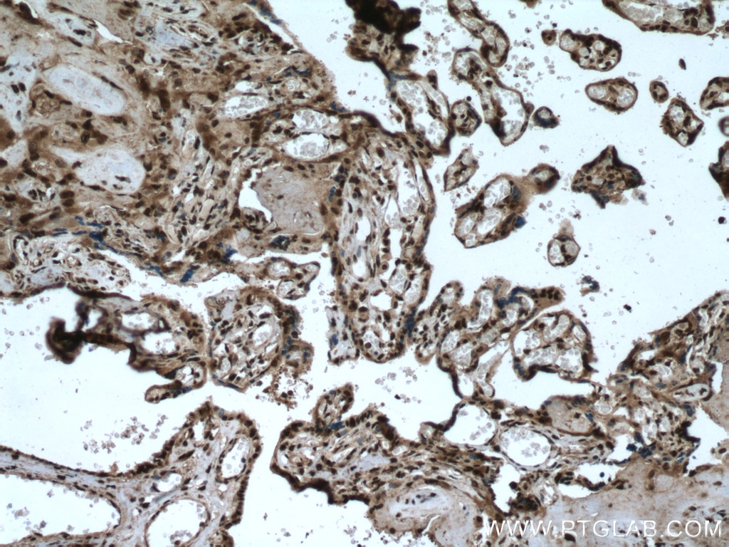 Immunohistochemistry (IHC) staining of human placenta tissue using SH3BGRL2 Polyclonal antibody (21944-1-AP)