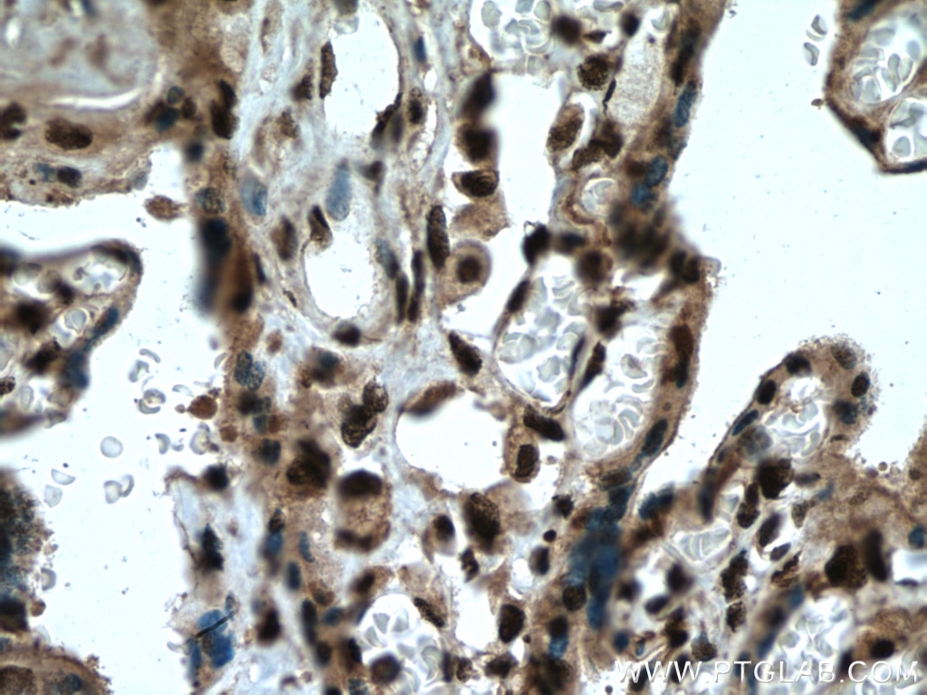 Immunohistochemistry (IHC) staining of human placenta tissue using SH3BGRL2 Polyclonal antibody (21944-1-AP)