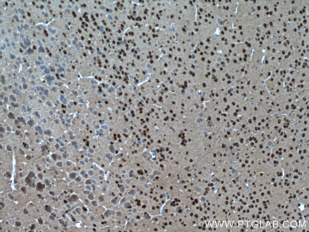 Immunohistochemistry (IHC) staining of mouse brain tissue using SH3BGRL2 Polyclonal antibody (21944-1-AP)