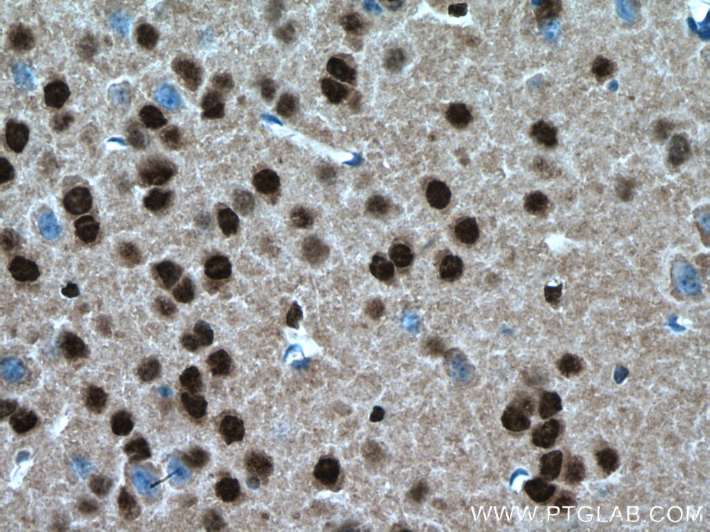 Immunohistochemistry (IHC) staining of mouse brain tissue using SH3BGRL2 Polyclonal antibody (21944-1-AP)