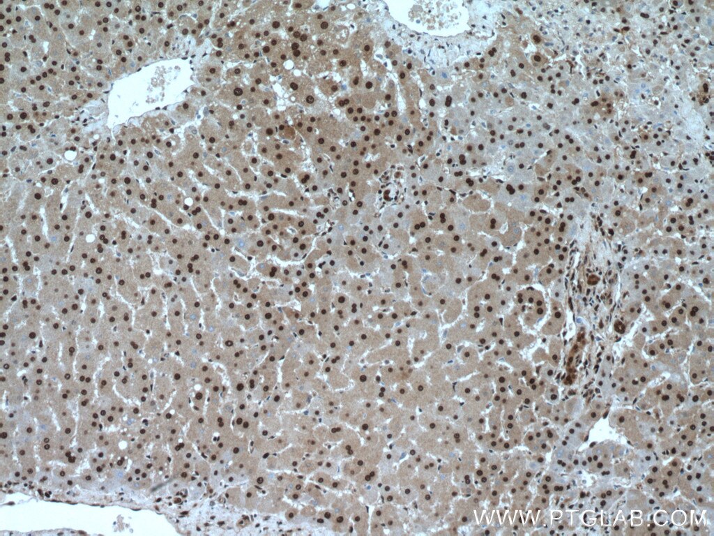 Immunohistochemistry (IHC) staining of human liver tissue using SH3BGRL2 Polyclonal antibody (21944-1-AP)