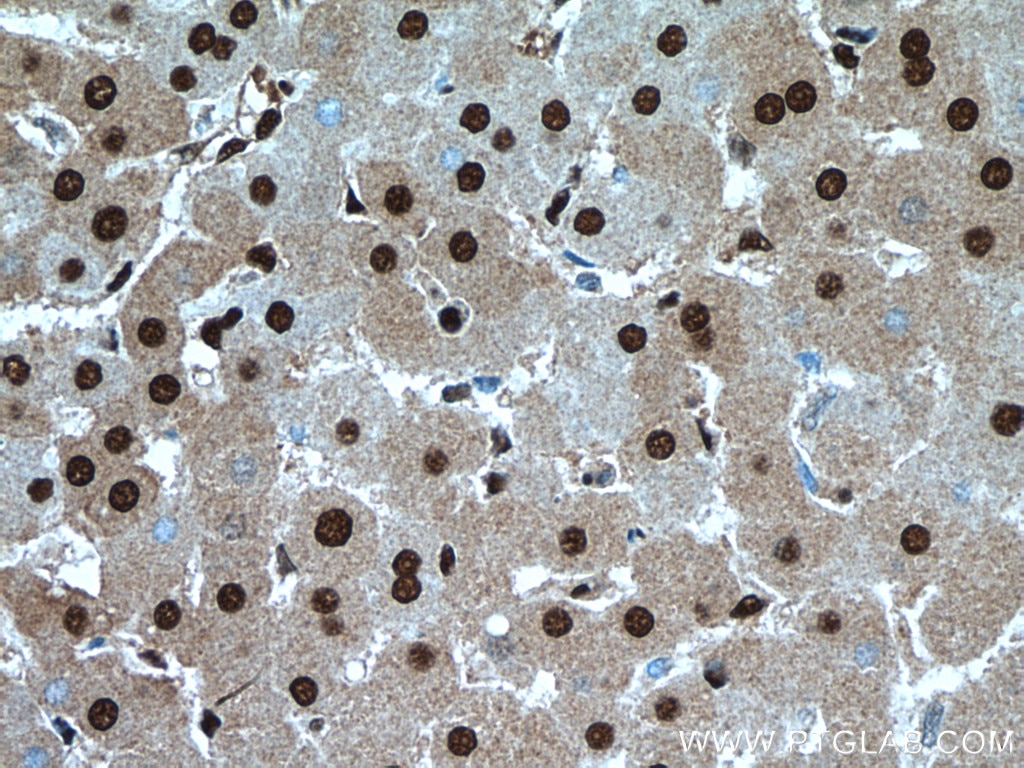 Immunohistochemistry (IHC) staining of human liver tissue using SH3BGRL2 Polyclonal antibody (21944-1-AP)