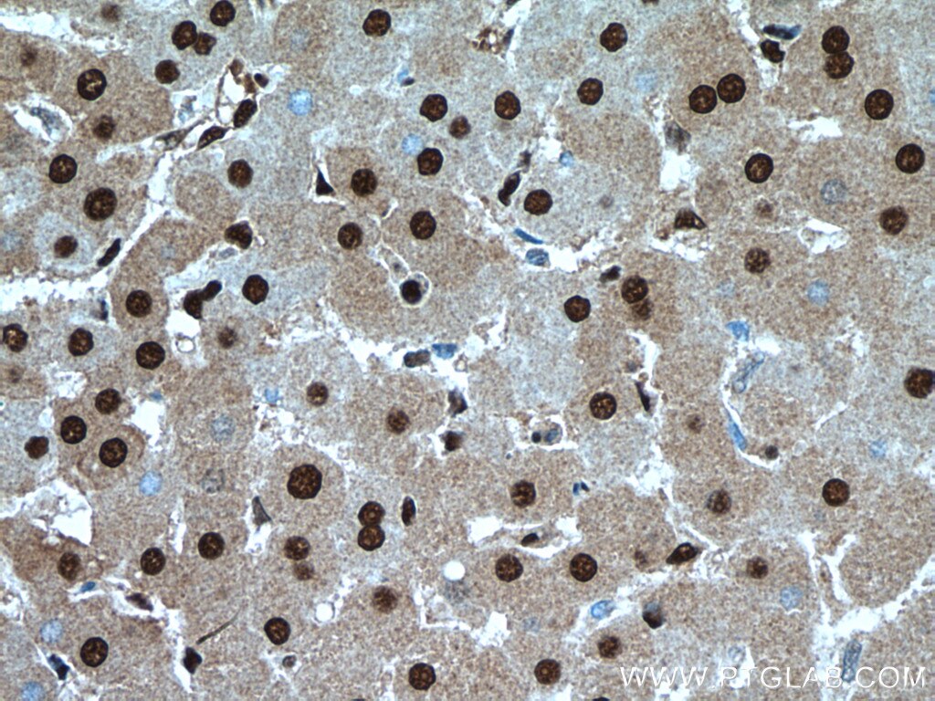 IHC staining of human liver using 21944-1-AP