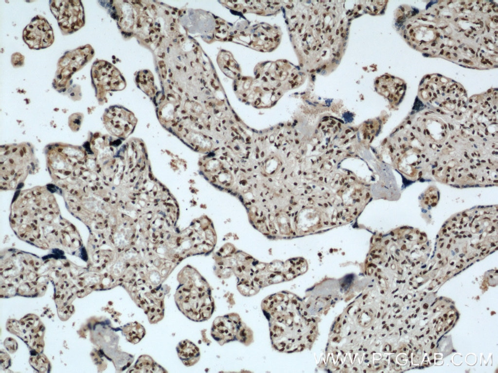 Immunohistochemistry (IHC) staining of human placenta tissue using SH3BGRL2 Polyclonal antibody (21944-1-AP)
