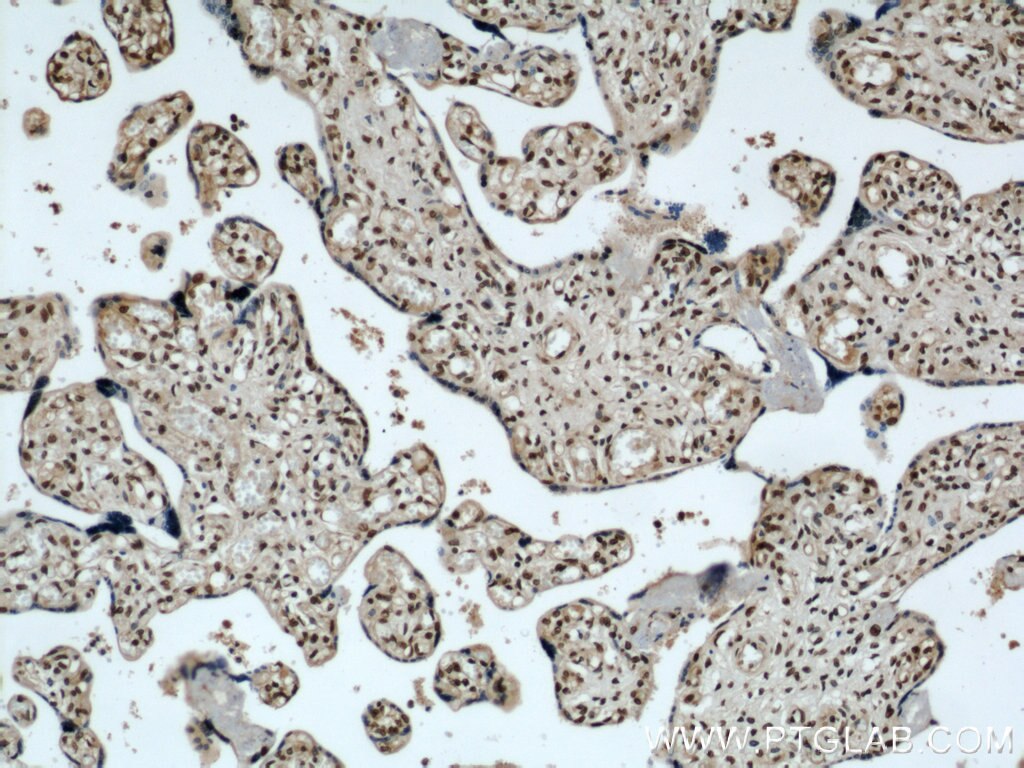 IHC staining of human placenta using 21944-1-AP