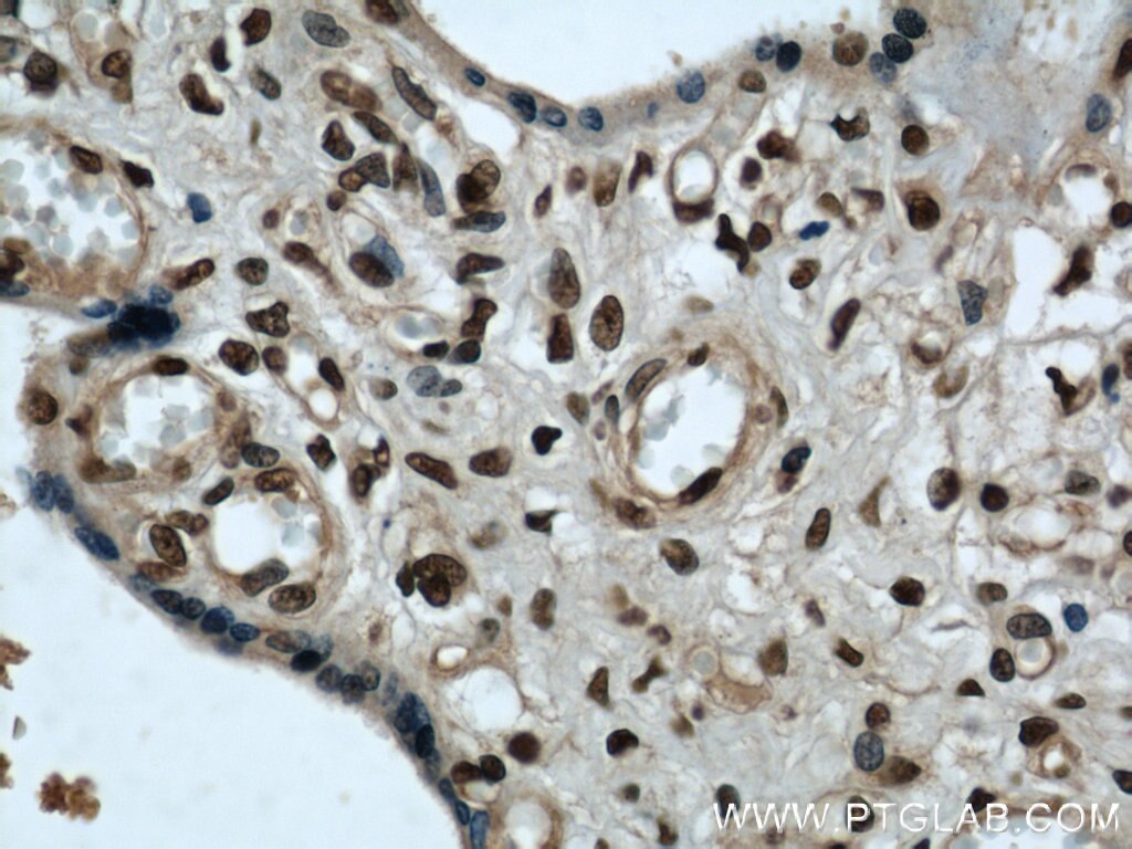 Immunohistochemistry (IHC) staining of human placenta tissue using SH3BGRL2 Polyclonal antibody (21944-1-AP)