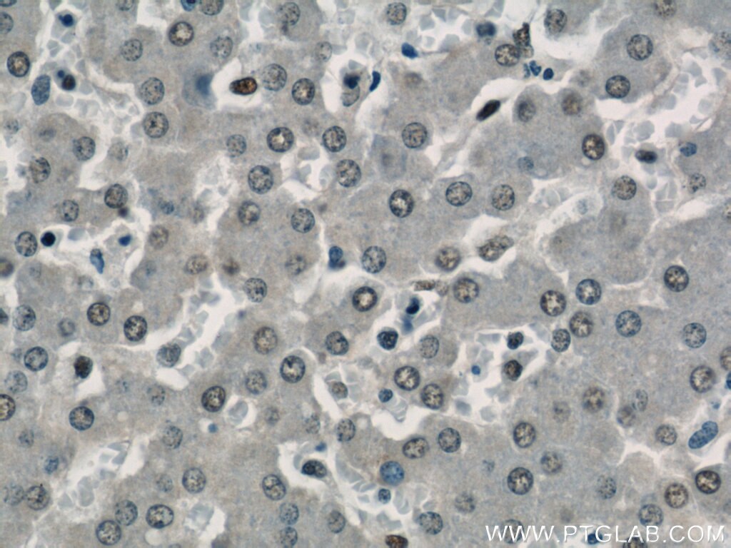 Immunohistochemistry (IHC) staining of human liver tissue using SH3BGRL2 Polyclonal antibody (21944-1-AP)