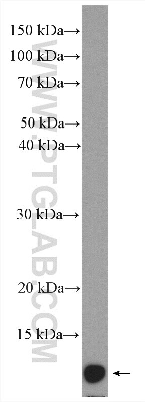 Western Blot (WB) analysis of human placenta tissue using SH3BGRL2 Polyclonal antibody (21944-1-AP)