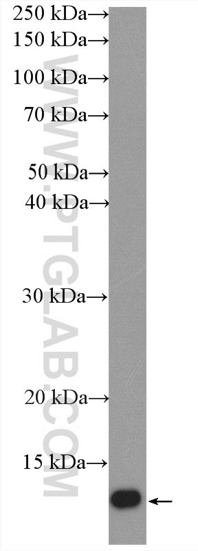 Western Blot (WB) analysis of mouse brain tissue using SH3BGRL2 Polyclonal antibody (21944-1-AP)