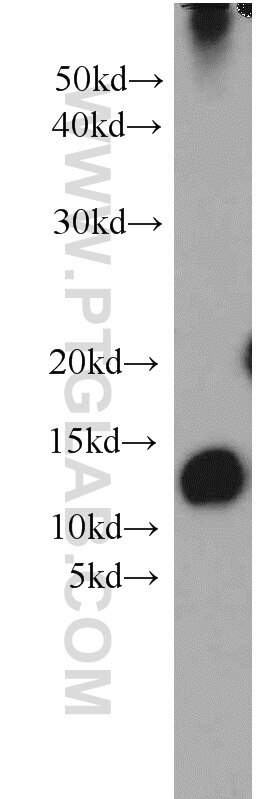 Western Blot (WB) analysis of human placenta tissue using SH3BGRL2 Polyclonal antibody (21944-1-AP)