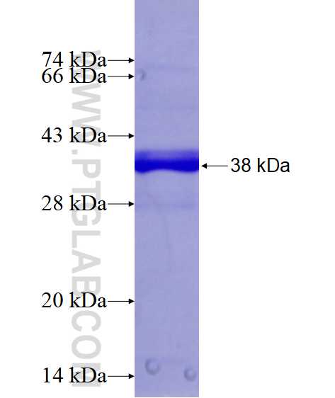 SH3BGRL2 fusion protein Ag16638 SDS-PAGE
