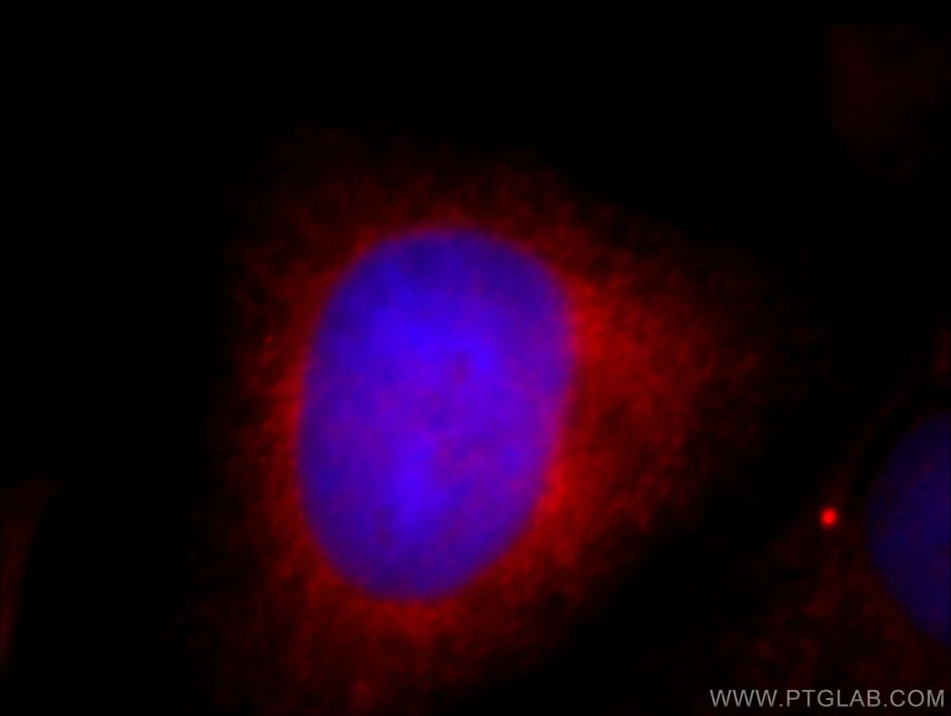Immunofluorescence (IF) / fluorescent staining of HeLa cells using SH3BP1 Polyclonal antibody (20541-1-AP)