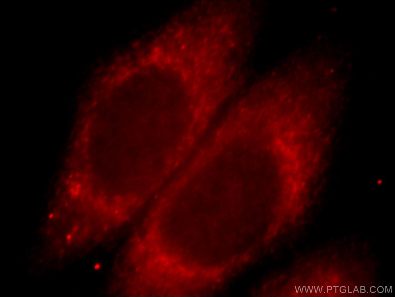 Immunofluorescence (IF) / fluorescent staining of HepG2 cells using SH3BP1 Polyclonal antibody (20541-1-AP)