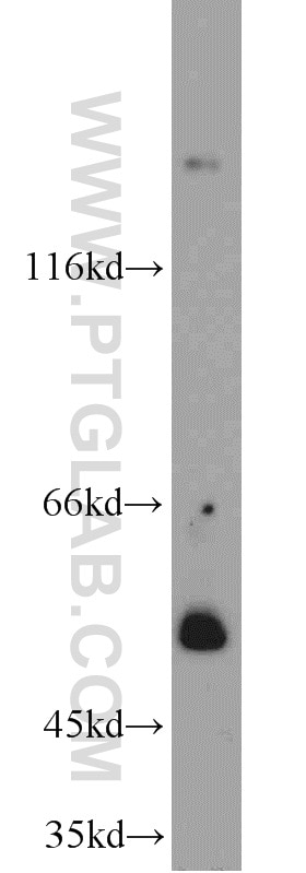 Western Blot (WB) analysis of HeLa cells using SH3BP1 Polyclonal antibody (20541-1-AP)