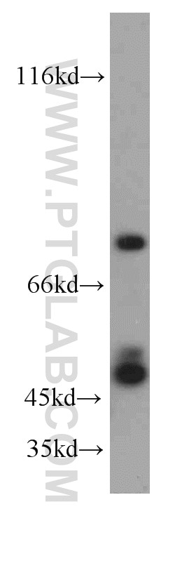 Western Blot (WB) analysis of mouse brain tissue using SH3BP1 Polyclonal antibody (20541-1-AP)