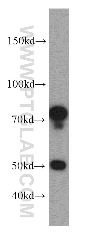 Western Blot (WB) analysis of mouse lung tissue using SH3BP1 Polyclonal antibody (20541-1-AP)
