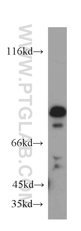 Western Blot (WB) analysis of mouse spleen tissue using SH3BP1 Polyclonal antibody (20541-1-AP)