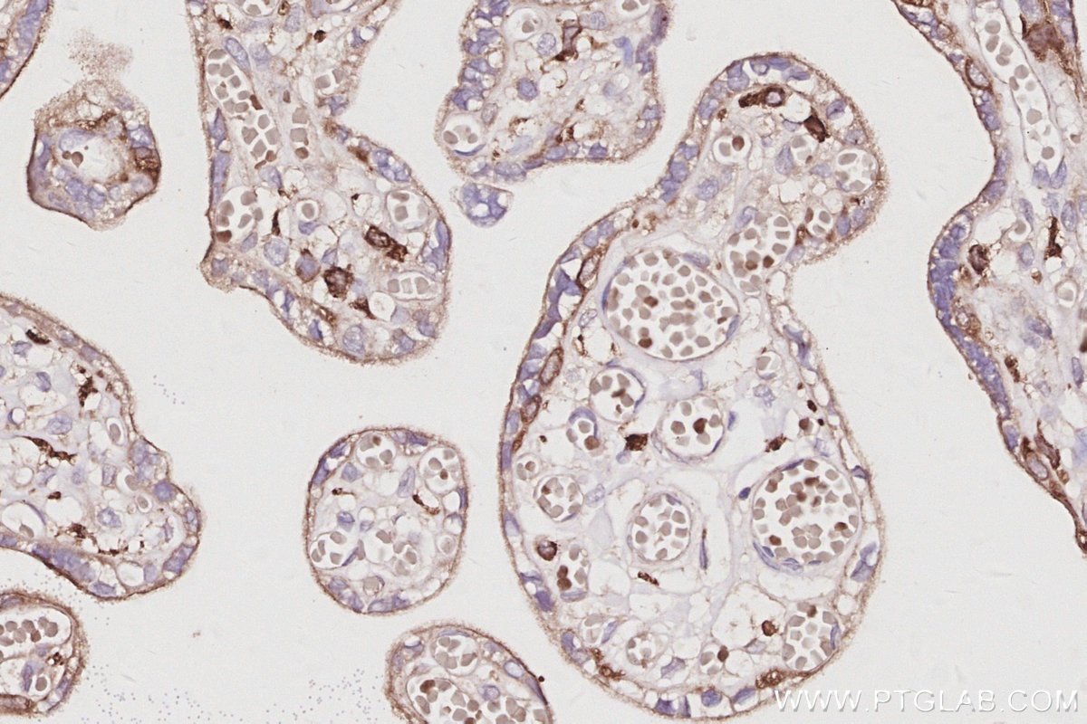 Immunohistochemistry (IHC) staining of human placenta tissue using SH3BP1 Monoclonal antibody (68328-1-Ig)