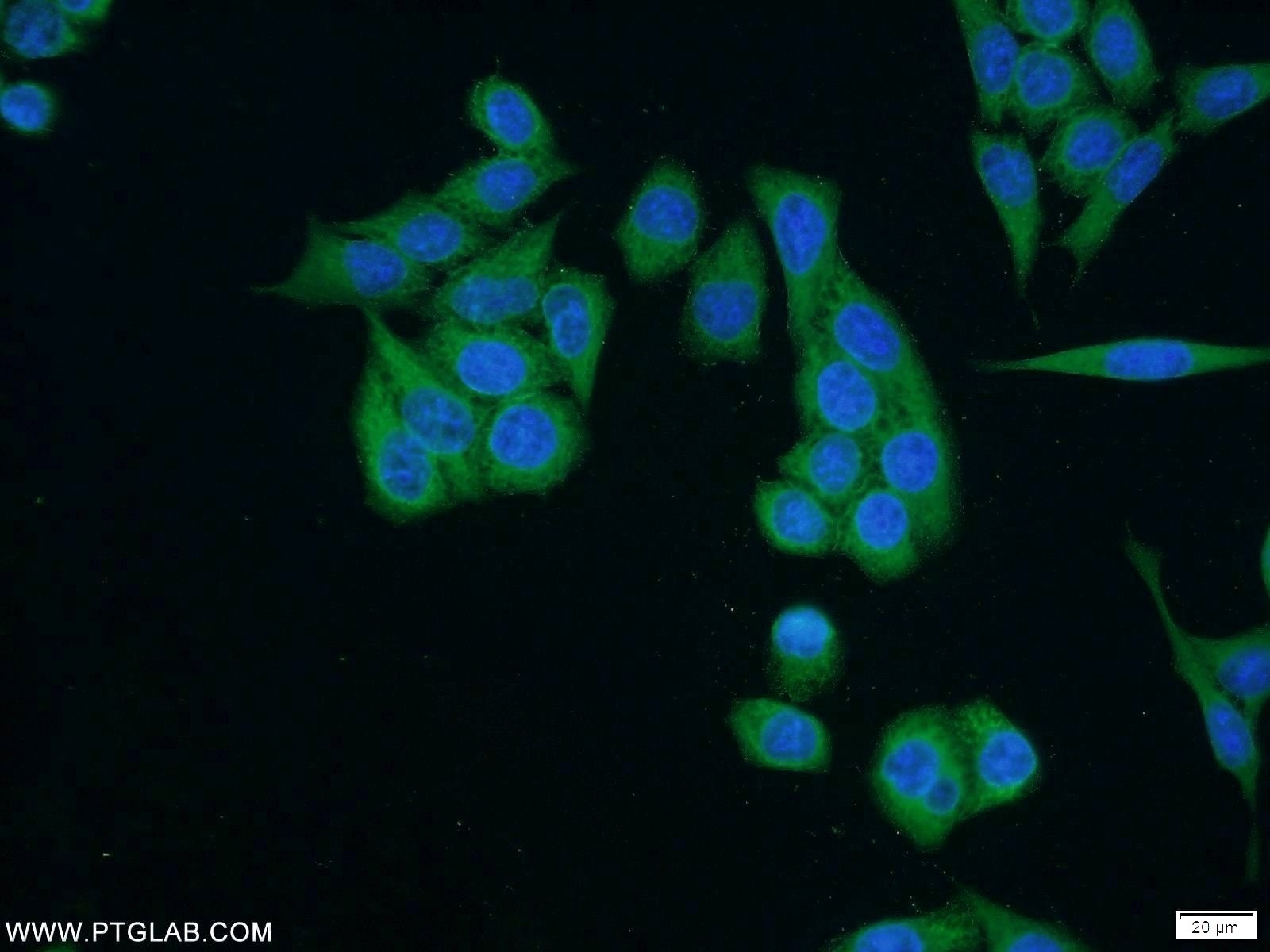 Immunofluorescence (IF) / fluorescent staining of HeLa cells using SH3BP4 Polyclonal antibody (17691-1-AP)