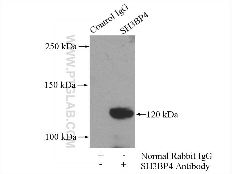Immunoprecipitation (IP) experiment of mouse lung tissue using SH3BP4 Polyclonal antibody (17691-1-AP)