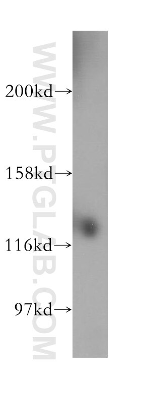 Western Blot (WB) analysis of HeLa cells using SH3BP4 Polyclonal antibody (17691-1-AP)