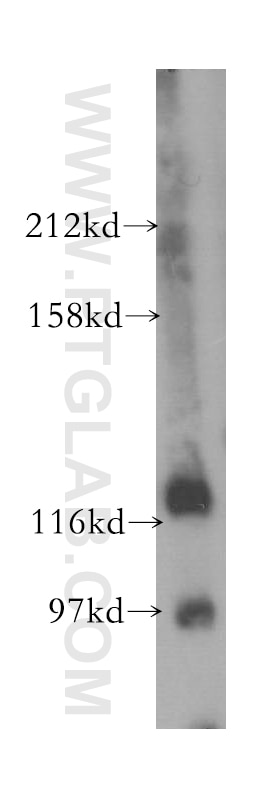 Western Blot (WB) analysis of mouse lung tissue using SH3BP4 Polyclonal antibody (17691-1-AP)