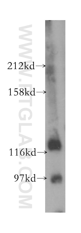 WB analysis of mouse lung using 17691-1-AP